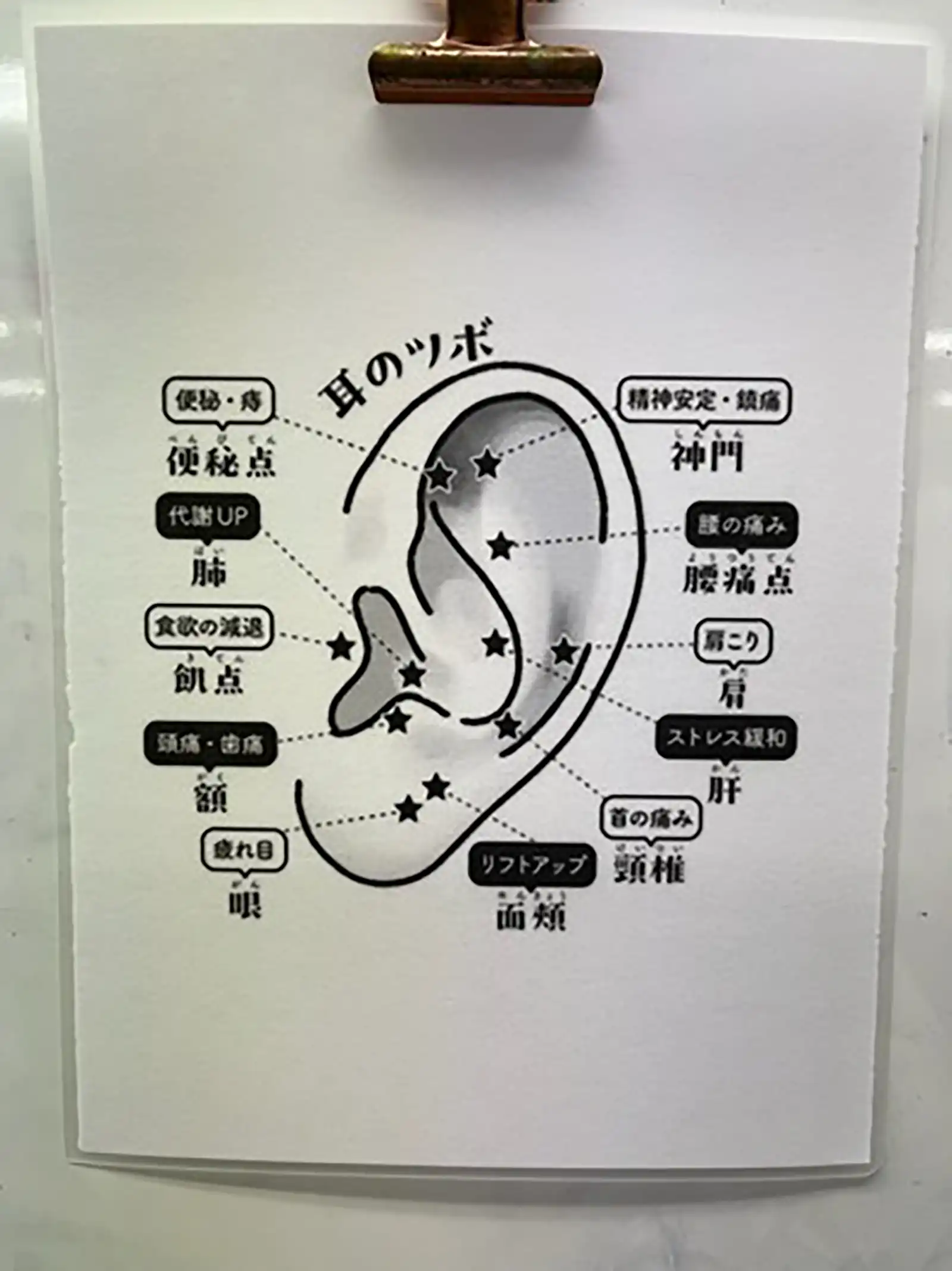 20250904グループワーク「防災の日|台風対策」耳のツボ資料画像